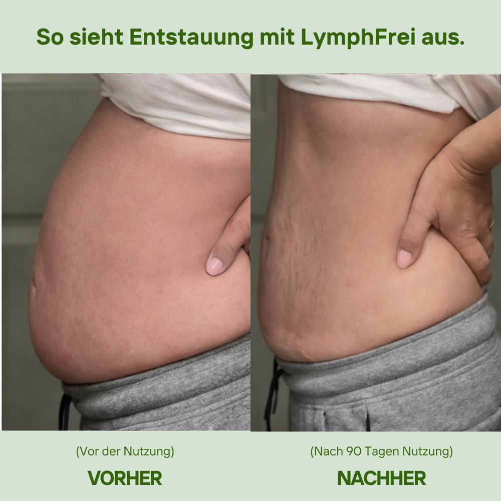 Alimora - LymphFrei