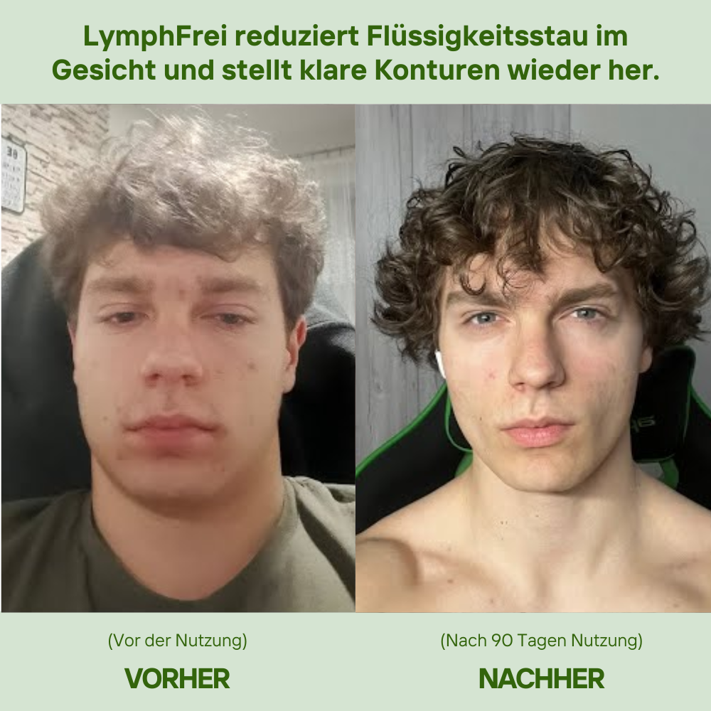 Alimora - LymphFrei